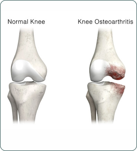 Bones and joints illustration