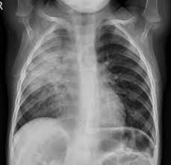 Pediatric diagnostic investigations imagery