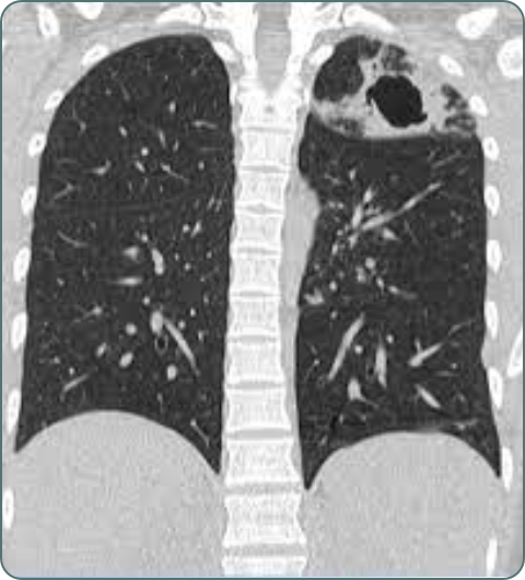 Pulmonology diagnostic investigations imagery