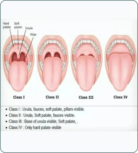 Anesthesia and pain management illustration