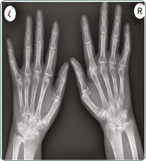Rheumatology diagnostic investigations imagery