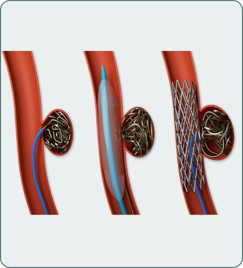 Interventional radiology treatments and procedures imagery