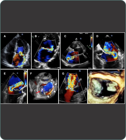 CTVS diagnostic investigations imagery