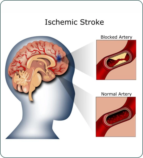 Brain and nervous system illustration